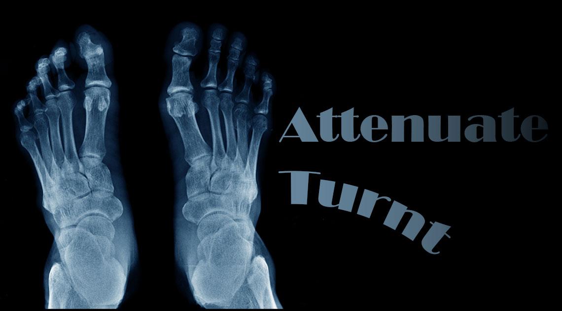 Attenuate and Turnt X-Ray Feet